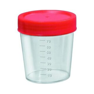 Coletor Universal J. Prolab estéril, vermelho com capacidade de 80mL
